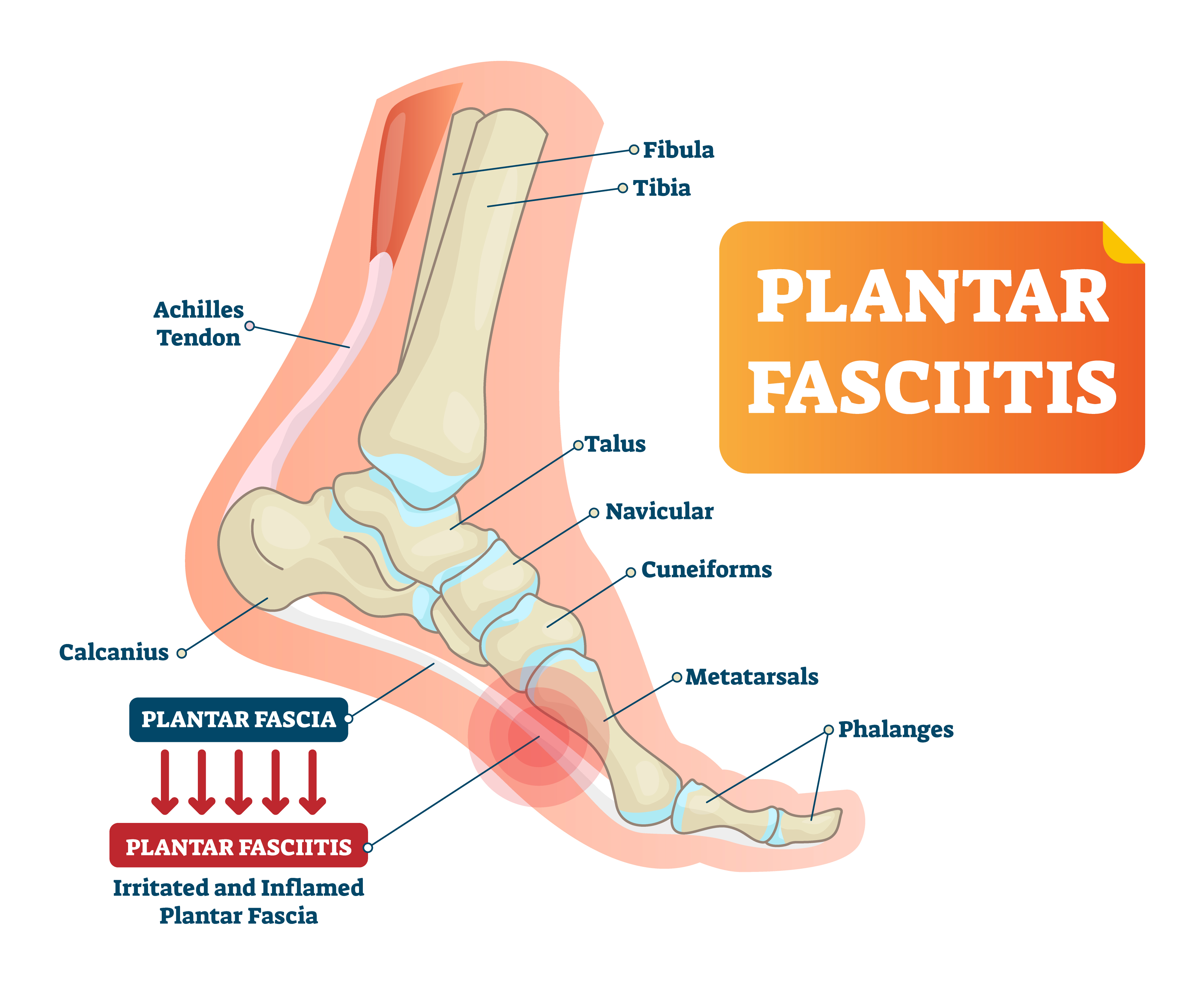 Ankle Pain Treatment Without Injection Or Surgery In Malaysia